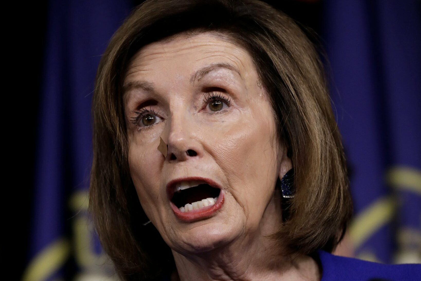House Speaker Nancy Pelosi’s nose has been bandaged for over a we...